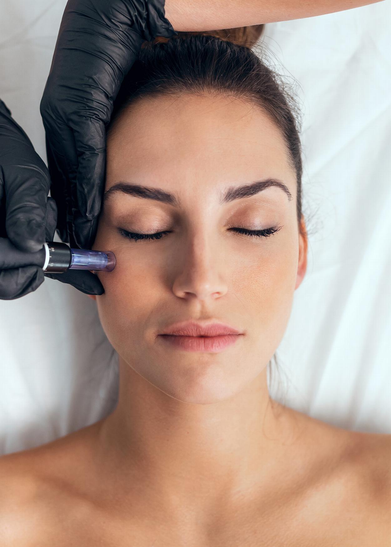 Woman receiving mesotherapy treatment